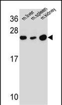 FAM180A Antibody (Center)