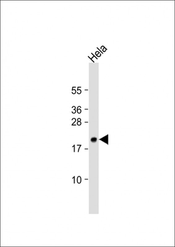 TMEM97 Antibody (N-term)