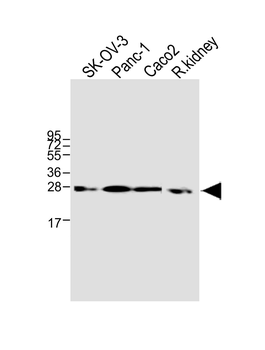TMEM97 Antibody (N-term)