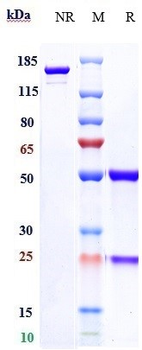 Anti-Zaire Ebola virus Reference Antibody (Cosfroviximab)