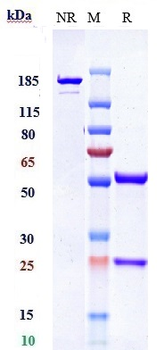 Anti-PDGFRB / CD140b Reference Antibody (IMC-2C5)