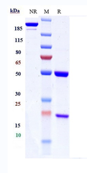 IGF1R / CD221 Reference Antibody