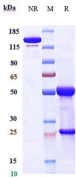 Anti-GREM1 / Gremlin Reference Antibody