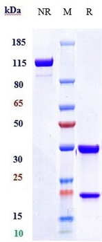 CEACAM5 / CEA / CD66e Reference Antibody (tusamitamab ravtansine)