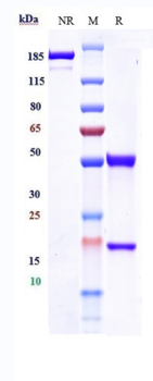 Anti-Amyloid Beta Reference Antibody