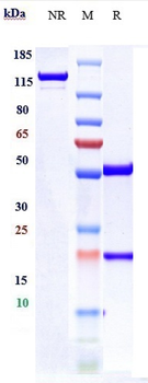 ENPP3 / CD203c Reference Antibody (Ags-16C3F)