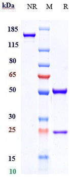 Anti-GPNMB Reference Antibody (glembatumumab)
