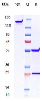 Anti-Amyloid Beta Reference Antibody (GSK 933776)