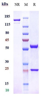 Anti-Adrenomedullin Reference Antibody (enibarcimab)
