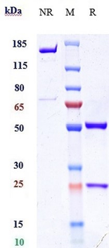 Anti-ERBB2 / HER2 / CD340 Reference Antibody (Trastuzumab duocarmazine)