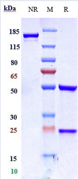 Anti-ERBB2 / HER2 / CD340 Reference Antibody (disitamab)