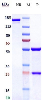 Anti-TNFSF7 / CD27L / CD70 Reference Antibody (vorsetuzumab)