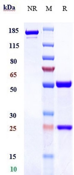 Anti-TNFSF7 / CD27L / CD70 Reference Antibody (Vorsetuzumab mafodotin)