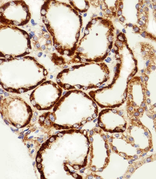 MPP7 Antibody (N-term)