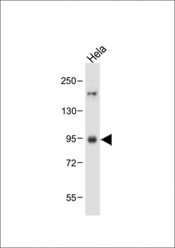 BRAF Antibody (T400)