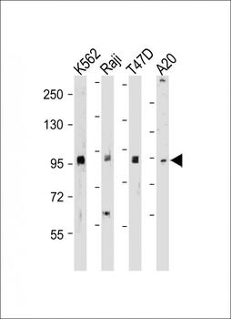 BRAF Antibody (T400)