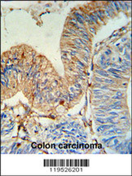 HLA-DRA Antibody (N-term)