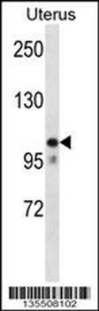 MOV10 Antibody (N-term)