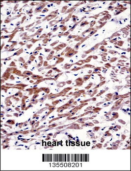 MOV10 Antibody (N-term)