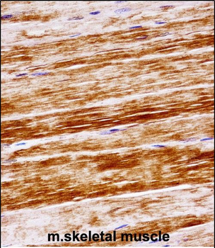 Mouse Prkcq Antibody (Center)