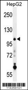SUV4-20H1 Antibody (C-term)