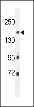 ITGA11 Antibody (N-term)