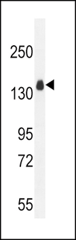 ITGA11 Antibody (N-term)