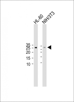 p27Kip1(S10) Antibody