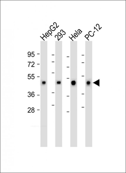PDHE1A(S232) Antibody