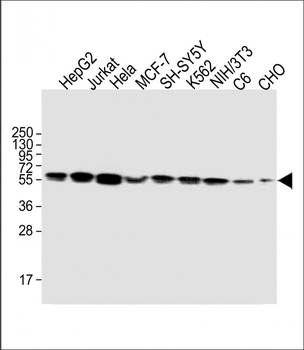 CALR Antibody (Center)