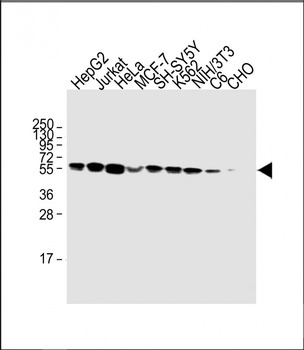 CALR Antibody (Center)
