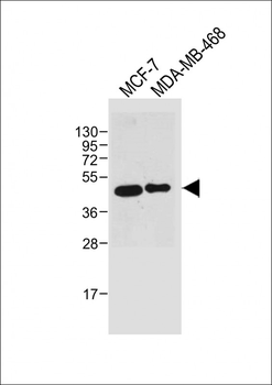 SULT2B1 Antibody