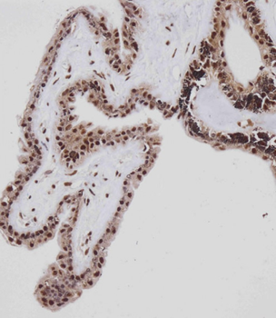 RB(S612) Antibody