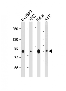 PLOD1 Antibody (C-term)