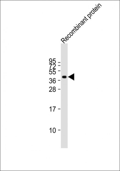 FAT4 Antibody