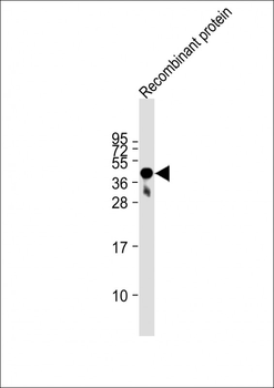 FAT4 Antibody