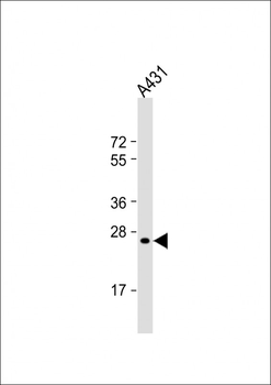 RAB5B Antibody