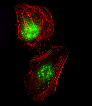 CREB(S133) Antibody