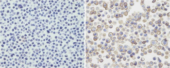 PDCD1LG2 Antibody (N-term)