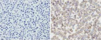 PDCD1LG2 Antibody (N-term)