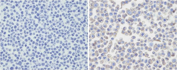 PDCD1LG2 Antibody (N-term)