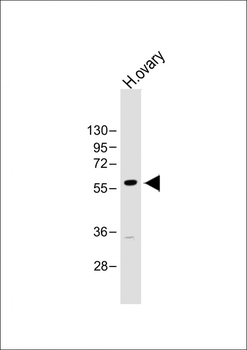 GRB14 Antibody (N-Term)
