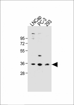 OR6C3 Antibody (Center)