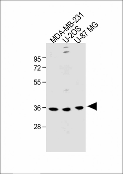 OR6C3 Antibody (Center)