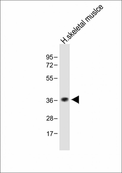 TAS2R5 Antibody (Center)