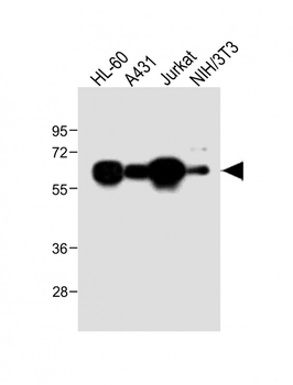 METTL14 Antibody (N-Term)