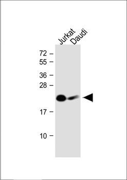 NCR3 Antibody (N-Term)