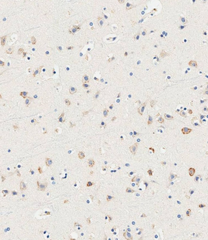 SLC14A2 Antibody (N-Term)