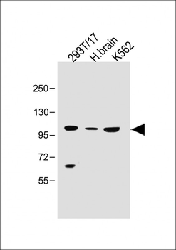 SLC14A2 Antibody (N-Term)
