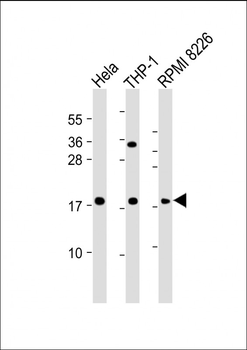 GPX7 Antibody (Center)